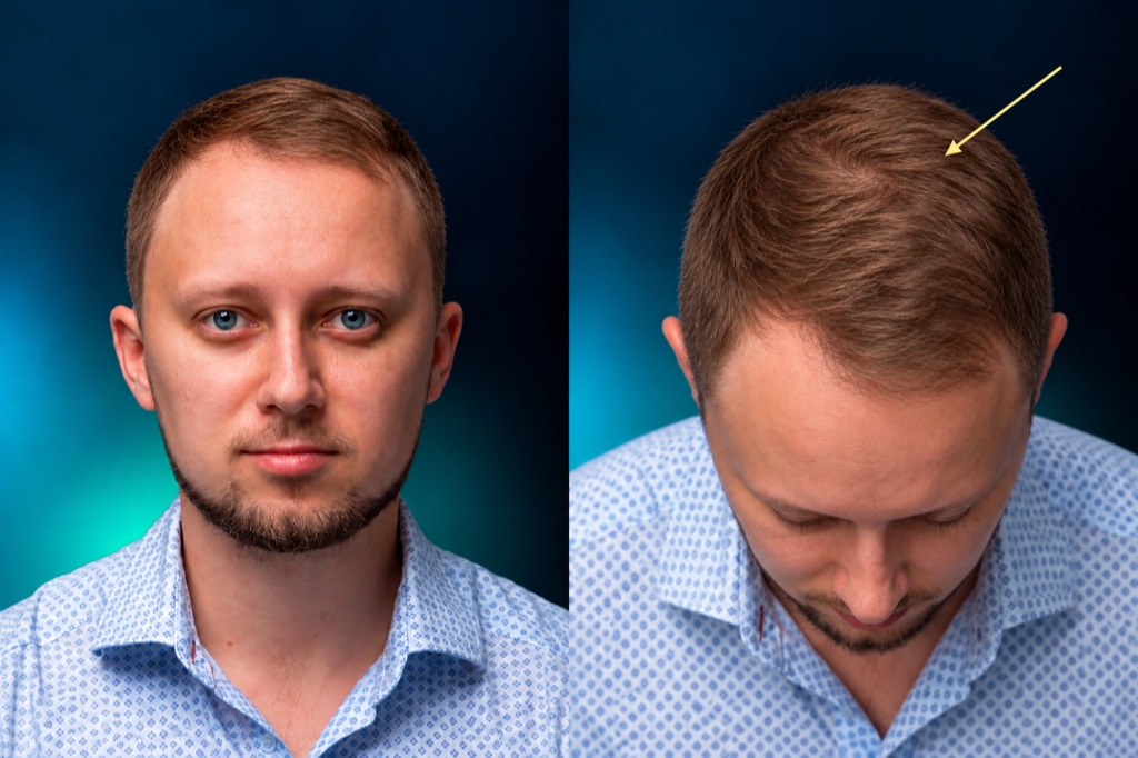 Alex, stage 0: Full head, front view